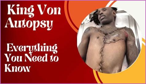 King Von Autopsy Report: Graphic Photos And Details